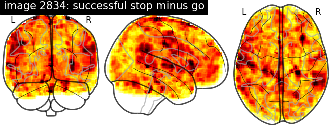 plot neurovault meta analysis