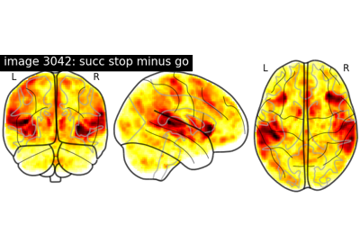 NeuroVault meta-analysis of stop-go paradigm studies.