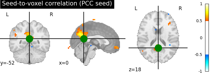 plot seed to voxel correlation