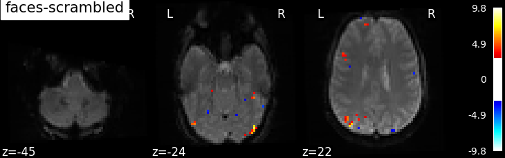 ../_images/sphx_glr_plot_spm_multimodal_faces_001.png