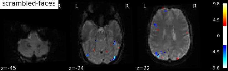 ../_images/sphx_glr_plot_spm_multimodal_faces_002.png