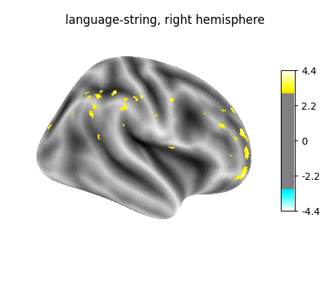 language-string, right hemisphere