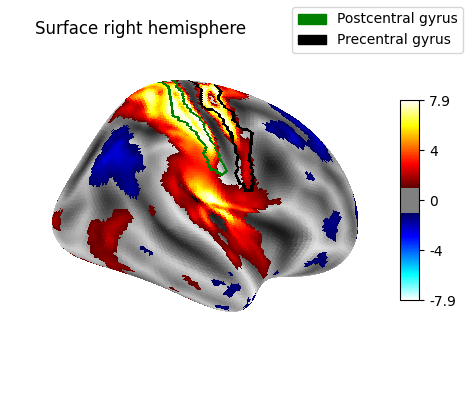 Surface right hemisphere