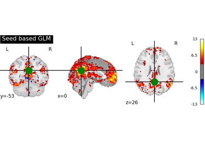 Default Mode Network extraction of AHDH dataset