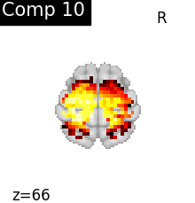 plot compare decomposition