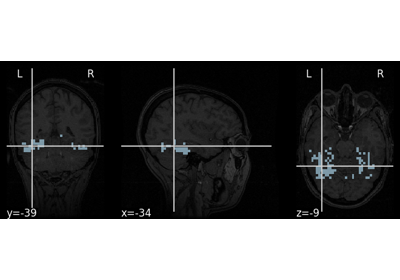 A introduction tutorial to fMRI decoding