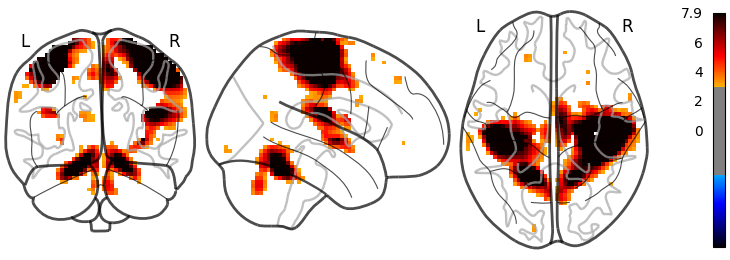 plot demo glass brain extensive