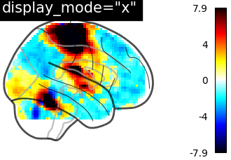 plot demo glass brain extensive