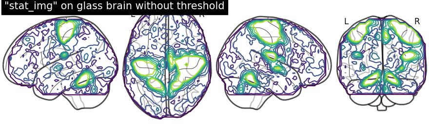 plot demo glass brain extensive