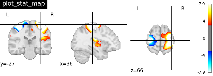 plot_stat_map