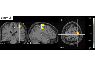 Controlling the contrast of the background when plotting