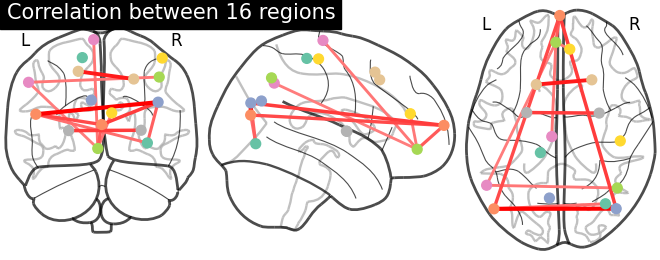 plot extract regions dictlearning maps