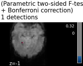 ../_images/sphx_glr_plot_haxby_mass_univariate_001.png