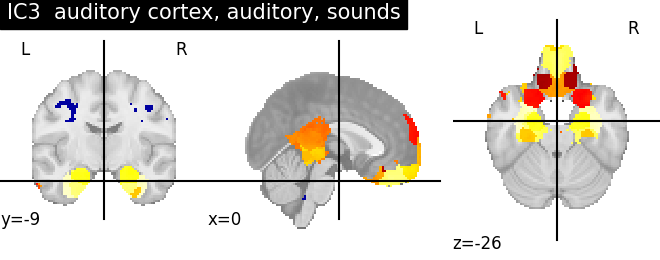 plot ica neurovault