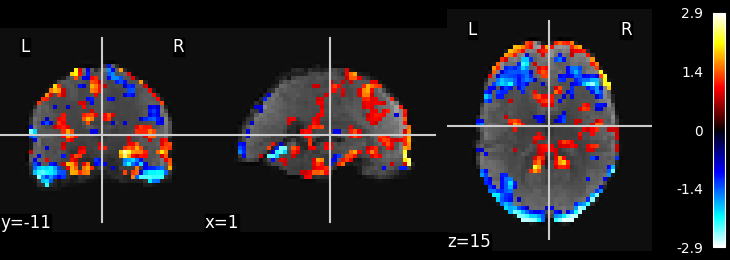 plot ica resting state