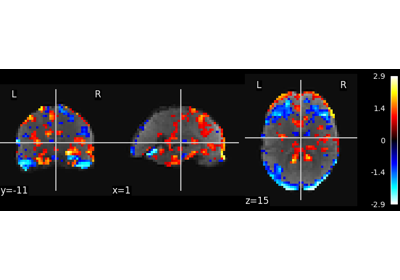 Multivariate decompositions: Independent component analysis of fMRI