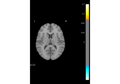 Massively univariate analysis of a motor task from the Localizer dataset