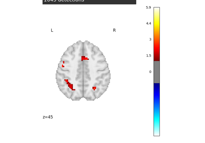 Massively univariate analysis of a calculation task from the Localizer dataset