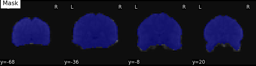 plot nifti simple