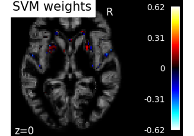 Voxel-Based Morphometry on Oasis dataset