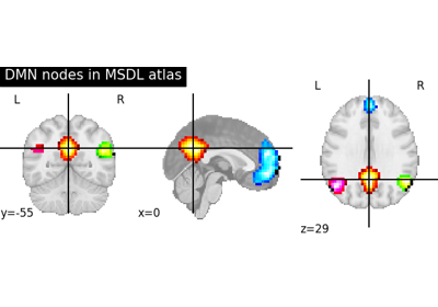 Visualizing a probabilistic atlas: the default mode in the MSDL atlas