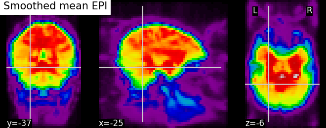 plot roi extraction