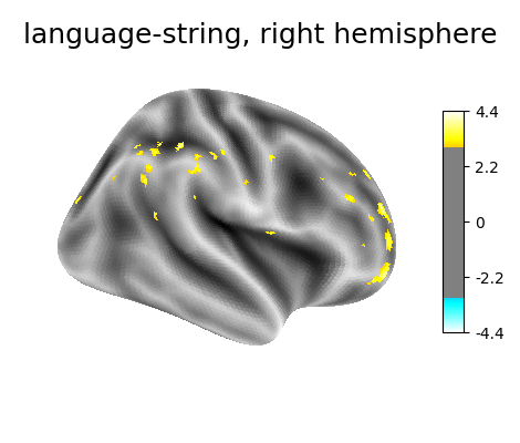 language-string, right hemisphere