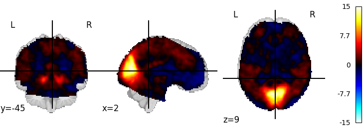 plot 3d and 4d niimg