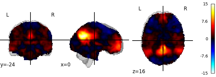 plot 3d and 4d niimg