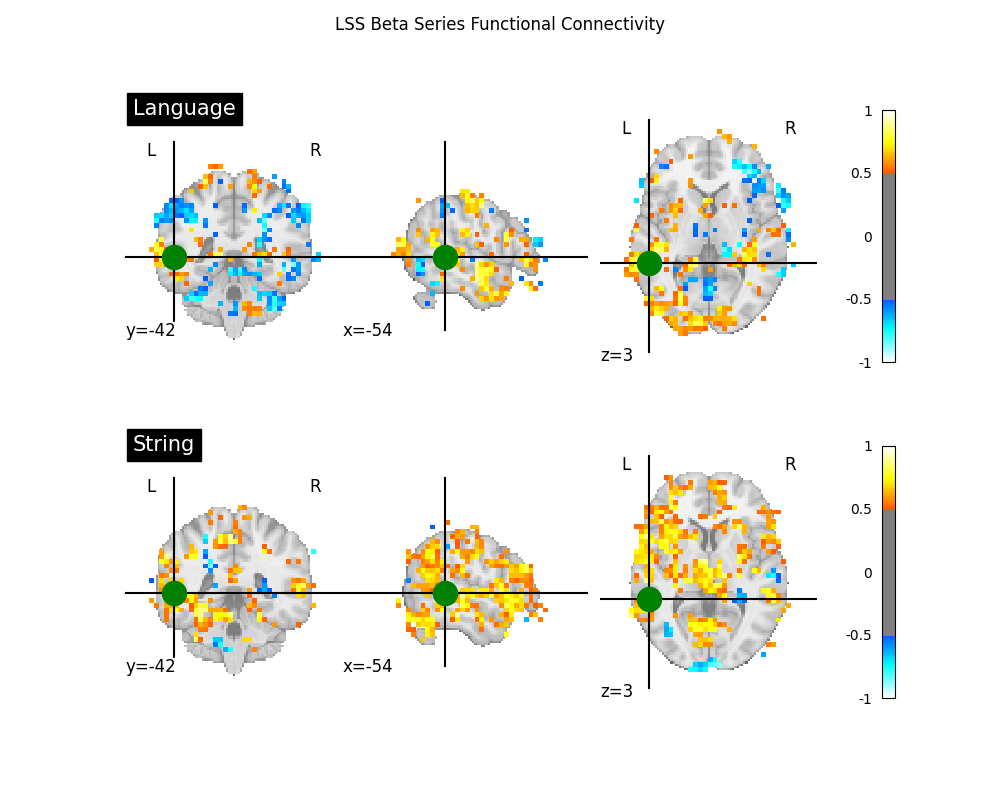 LSS Beta Series Functional Connectivity