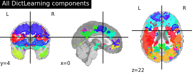 ../_images/sphx_glr_plot_compare_decomposition_022.png