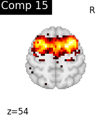 plot compare decomposition