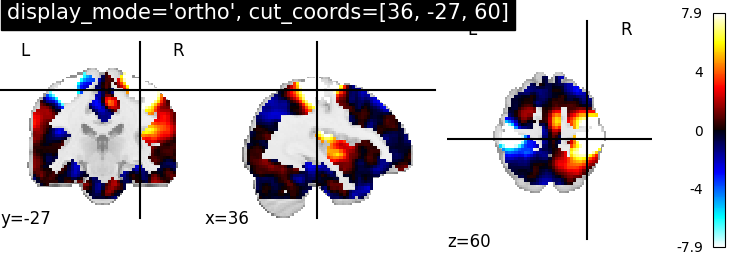 plot_ortho