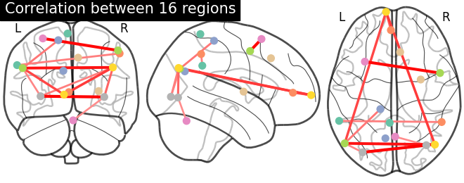 plot extract regions dictlearning maps