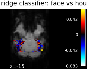 ../_images/sphx_glr_plot_haxby_different_estimators_004.png