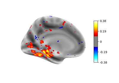 Cortical surface-based searchlight decoding