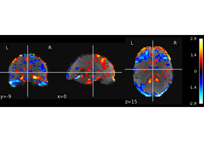 Multivariate decompositions: Independent component analysis of fMRI