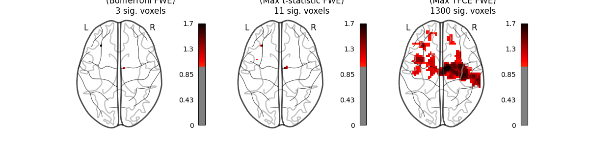 Group left button press ($-\log_{10}$ p-values), Parametric Test (Bonferroni FWE) 3 sig. voxels, Permutation Test (Max t-statistic FWE) 11 sig. voxels, Permutation Test (Max TFCE FWE) 1300 sig. voxels