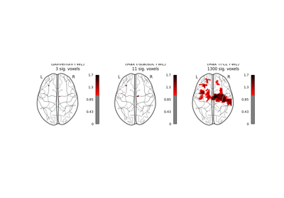 Massively univariate analysis of a motor task from the Localizer dataset