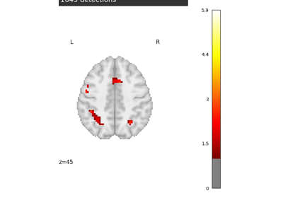 Massively univariate analysis of a calculation task from the Localizer dataset