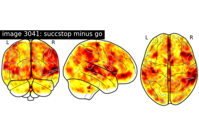 NeuroVault meta-analysis of stop-go paradigm studies.