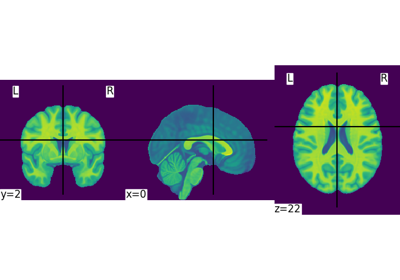 Basic nilearn example: manipulating and looking at data