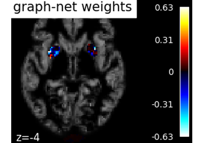 Voxel-Based Morphometry on Oasis dataset with Space-Net prior