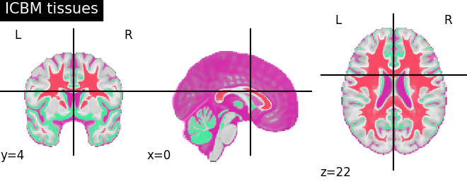 plot prob atlas