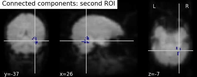 plot roi extraction