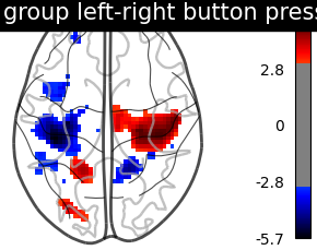 plot second level one sample test