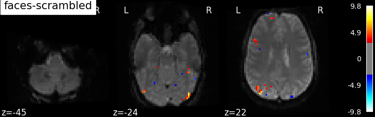 plot spm multimodal faces