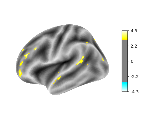 language-string, left hemisphere