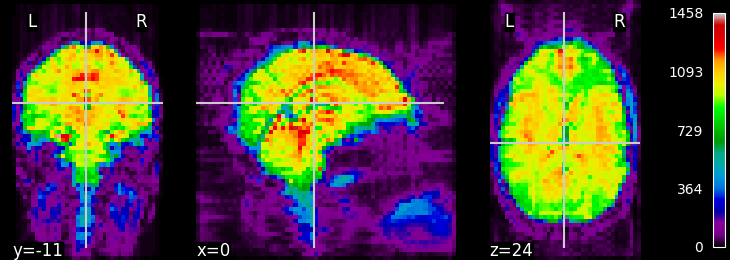 plot visualization