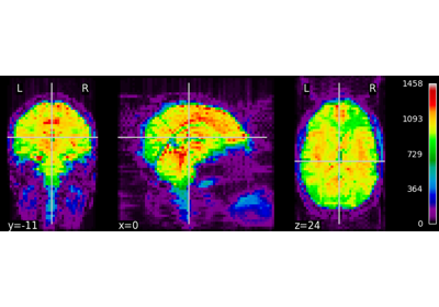 NeuroImaging volumes visualization